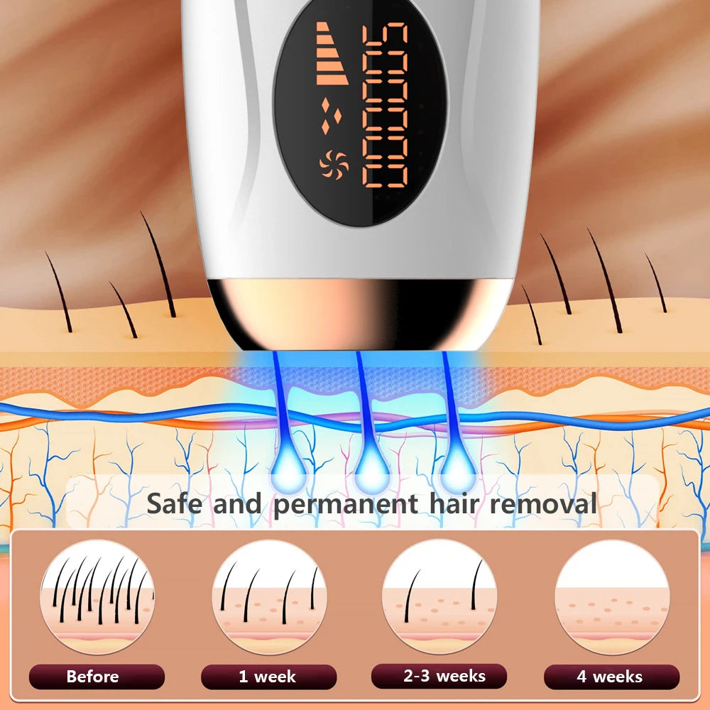 Portable IPL Laser Epilator 999999 Flashes - Painless, Permanent Hair Removal for Women’S Body and Bikini Line